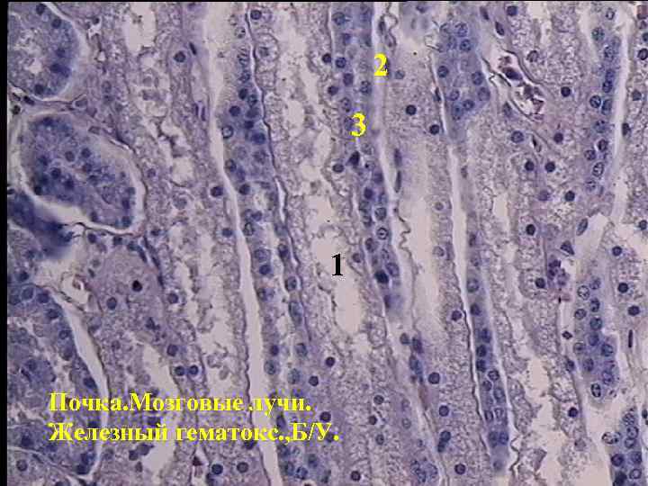 2 3 1 Почка. Мозговые лучи. Железный гематокс. , Б/У. 
