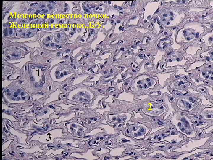 Мозговое вещество почки. Железный гематокс. , Б/У. 1 2 3 