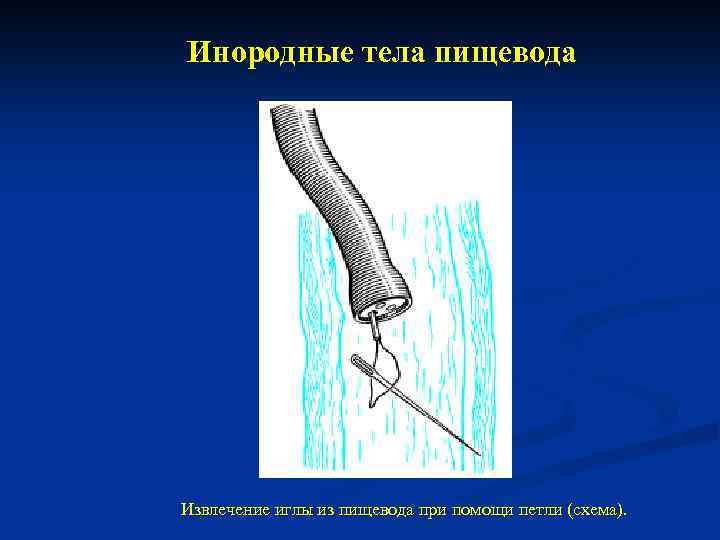 Инородное тело пищевода карта вызова скорой медицинской