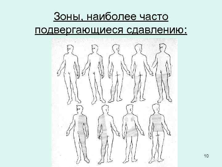 Зоны, наиболее часто подвергающиеся сдавлению: 10 