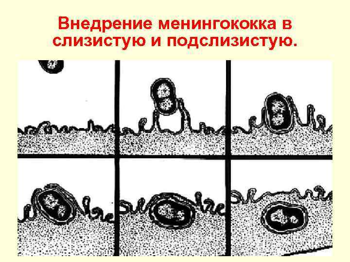 Внедрение менингококка в слизистую и подслизистую. 