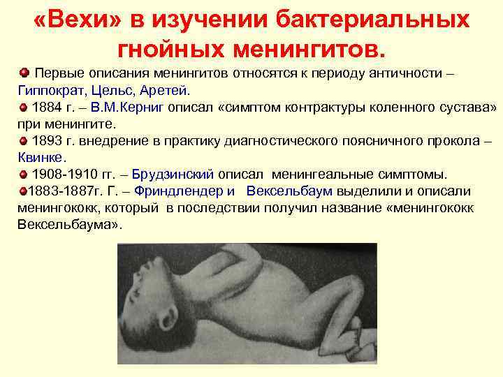  «Вехи» в изучении бактериальных гнойных менингитов. Первые описания менингитов относятся к периоду античности