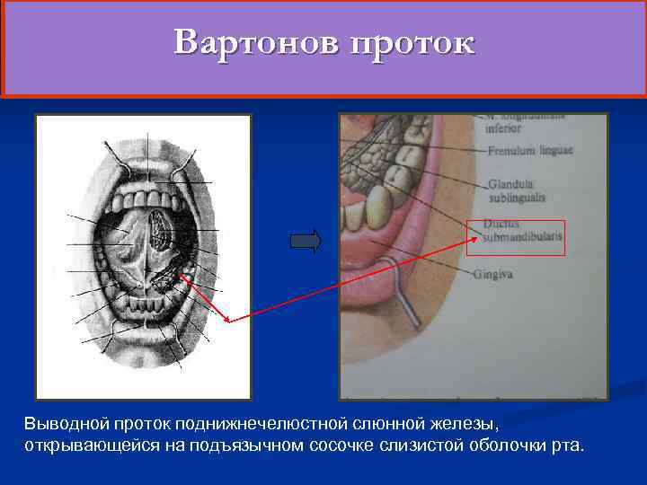  Вартонов проток Выводной проток поднижнечелюстной слюнной железы, открывающейся на подъязычном сосочке слизистой оболочки