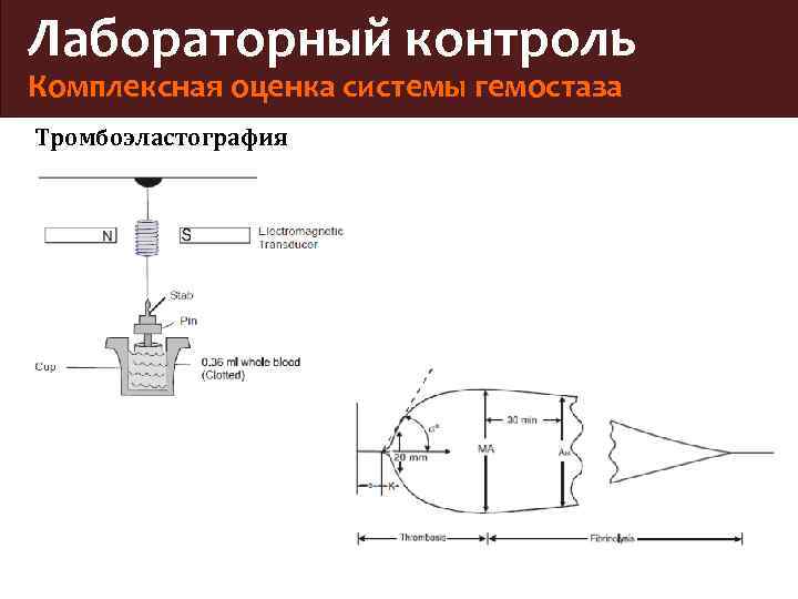 Лабораторный контроль Комплексная оценка системы гемостаза Тромбоэластография 