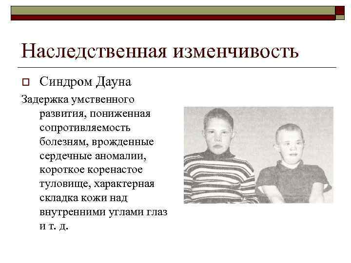 Наследственная изменчивость o Синдром Дауна Задержка умственного развития, пониженная сопротивляемость болезням, врожденные сердечные аномалии,