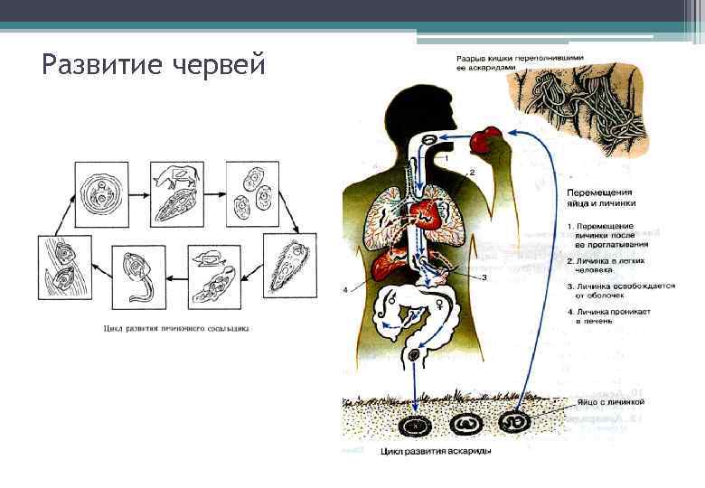 Развитие червей 