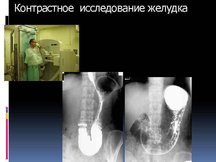 Рентгеноскопия контрастное вещество. Контрастное исследование желудка. Контрастное рентгенологическое исследование желудка. Рентгенологическое исследование органов пищеварительной системы. Рентген желудка с контрастом.