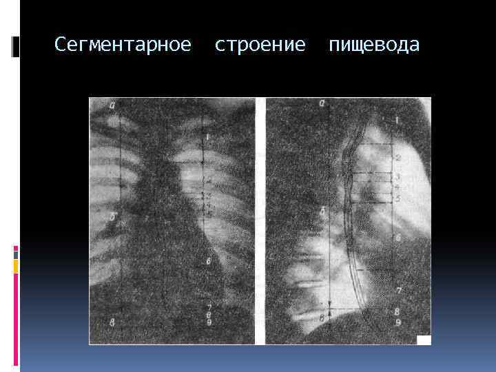 Сегментарное строение пищевода 