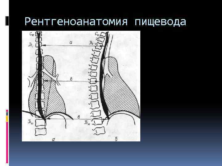 Прямая и боковая проекция. Анатомия пищевода рентген. Рентгеновская анатомия пищевода. Рентгеноанатомия пищевода. Ренгтен анатомия пищевода.