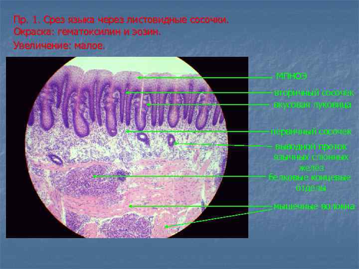 Пр. 1. Срез языка через листовидные сосочки. Окраска: гематоксилин и эозин. Увеличение: малое. МПНОЭ