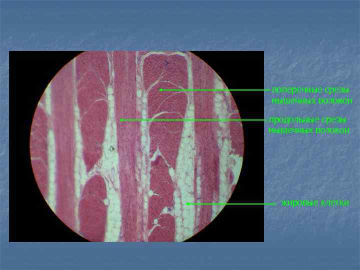 поперечные срезы мышечных волокон продольные срезы мышечных волокон жировые клетки 