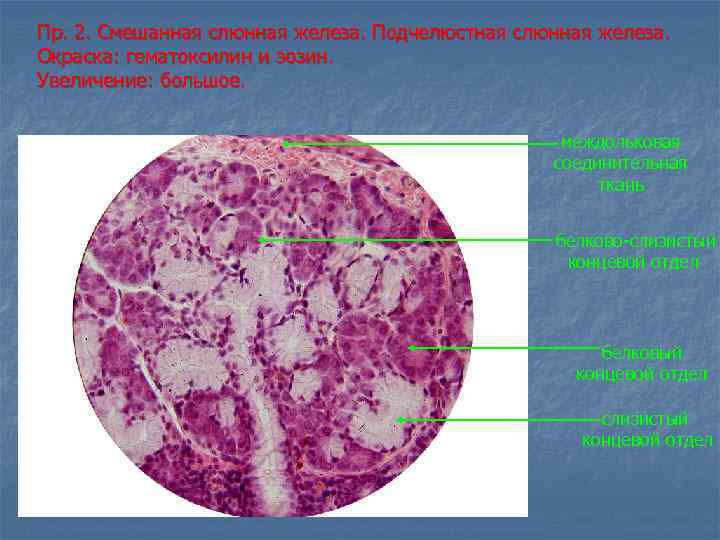 Пр. 2. Смешанная слюнная железа. Подчелюстная слюнная железа. Окраска: гематоксилин и эозин. Увеличение: большое.