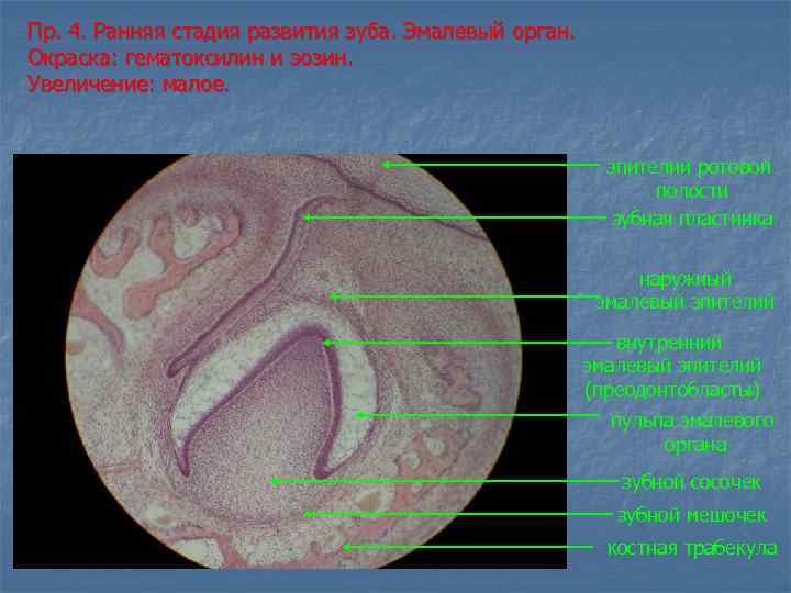 Увеличенная малая. Ранняя стадия развития зуба гистология. Ранняя стадия развития зуба гистология препарат. Эмалевый орган гематоксилин эозин. Развитие зуба эмалевый орган гистология препарат.