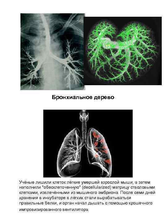 Бронхиальное дерево Учёные лишили клеток лёгкие умершей взрослой мыши, а затем наполнили "обесклеточенную" (decellularized)