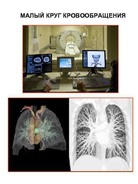 МАЛЫЙ КРУГ КРОВООБРАЩЕНИЯ 