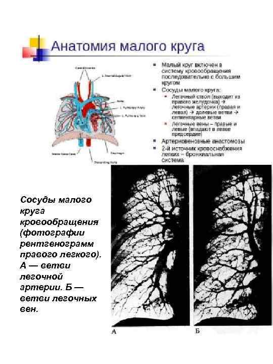 Деление легочной артерии схема