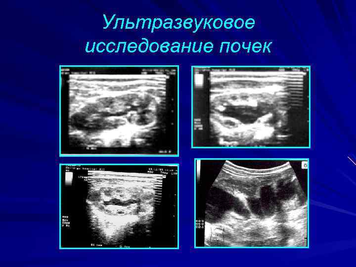 Обследование почек. Инструментальный метод исследования почек. Инструментальные методы обследования почек. Инструментальная методы исследования почек. Методы инструментального исследования почек.