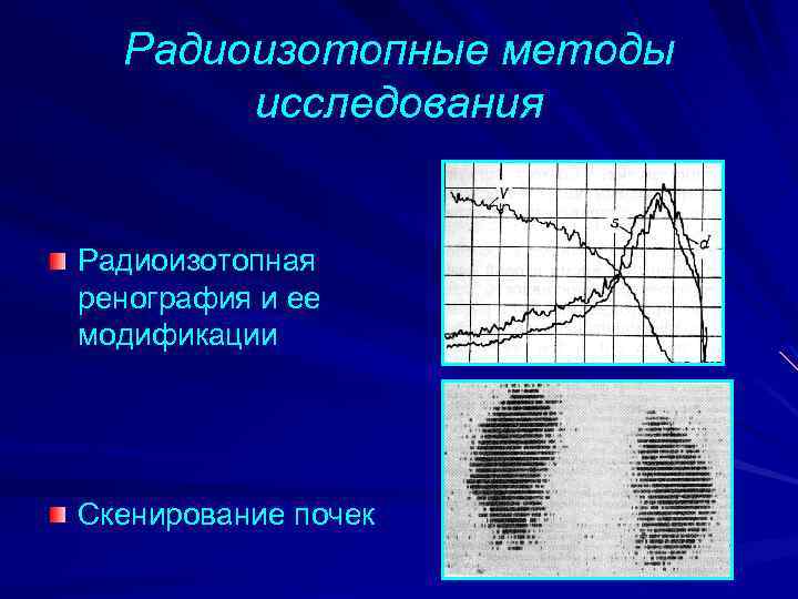 Радиоизотопные методы исследования в урологии презентация