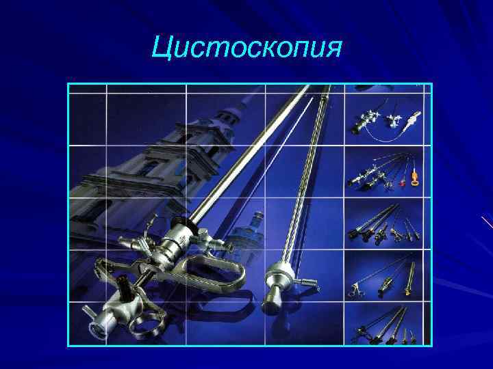 Цистоскопия 