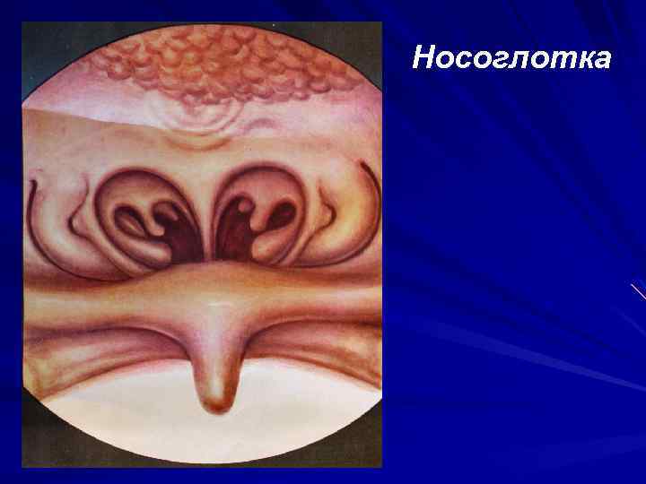 Носоглотка 