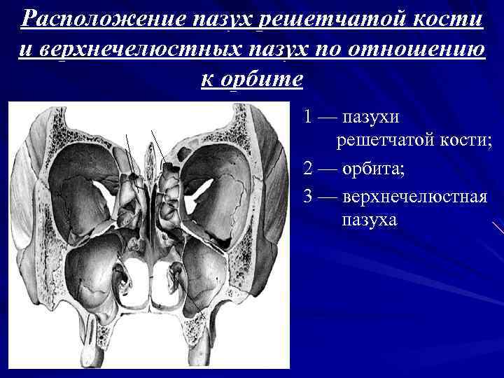 Пазуха верхнечелюстной кости