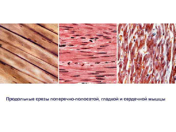 Продольные срезы поперечно полосатой, гладкой и сердечной мышцы 