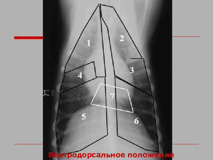 Вентродорсальное положение 