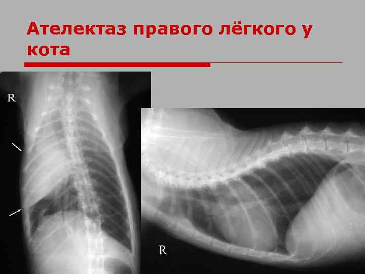 Ателектаз правого лёгкого у кота 