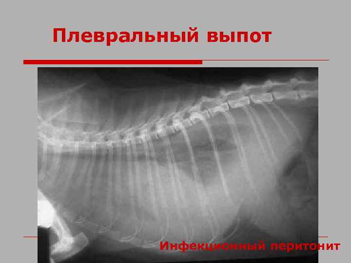 Плевральный выпот Инфекционный перитонит 