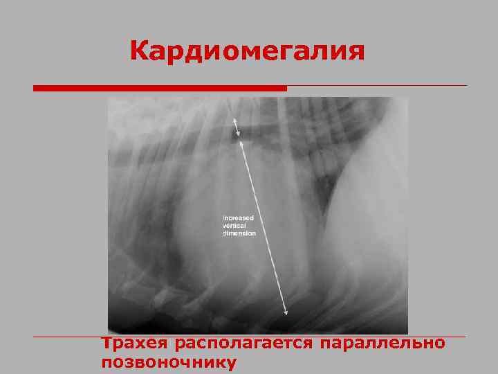 Кардиомегалия Трахея располагается параллельно позвоночнику 