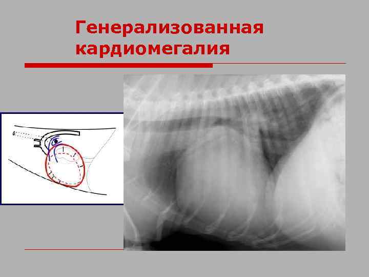 Генерализованная кардиомегалия 