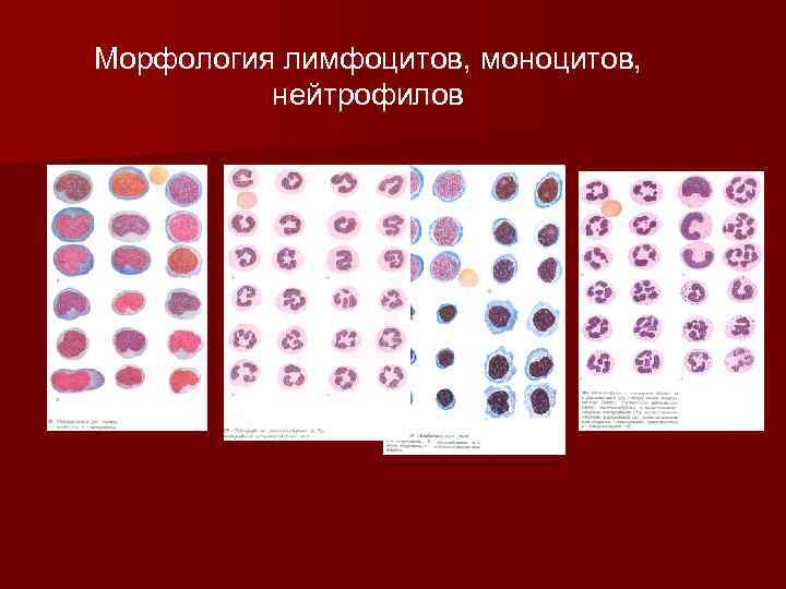 Морфология лимфоцитов, моноцитов, нейтрофилов 