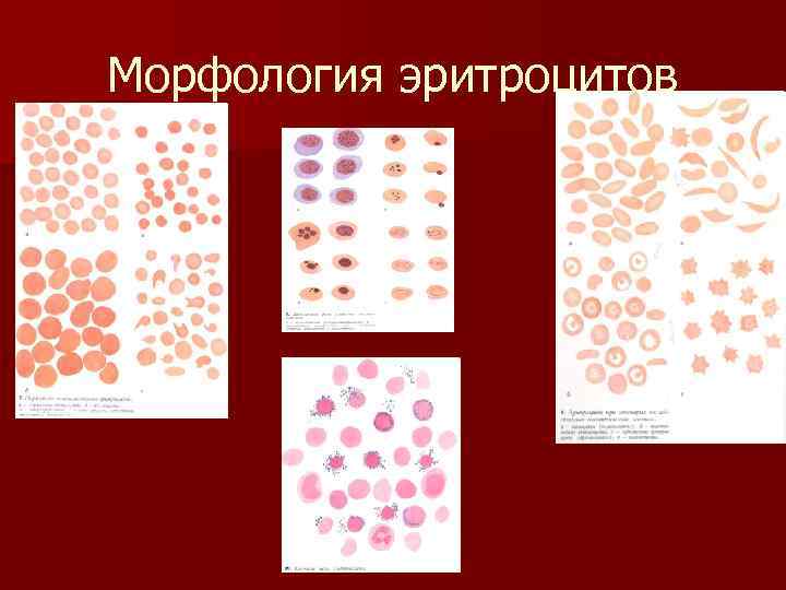 Морфология эритроцитов 
