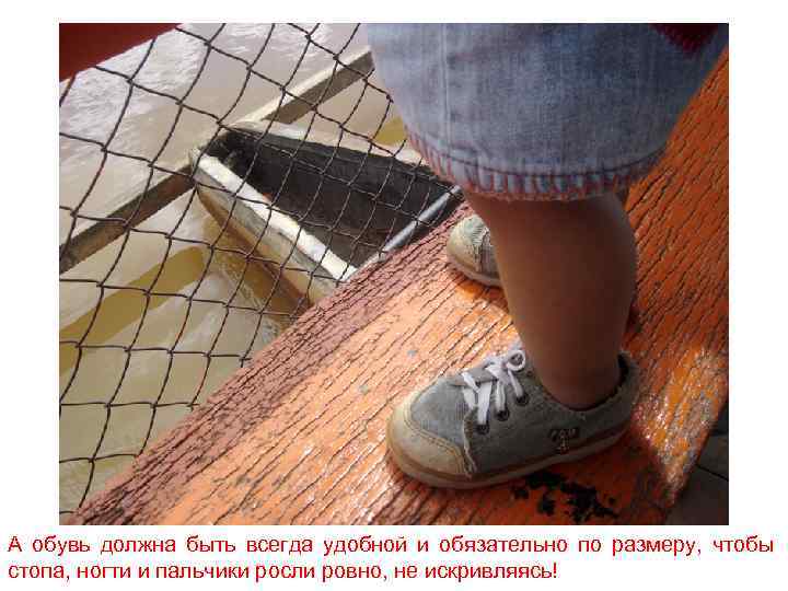 А обувь должна быть всегда удобной и обязательно по размеру, чтобы стопа, ногти и