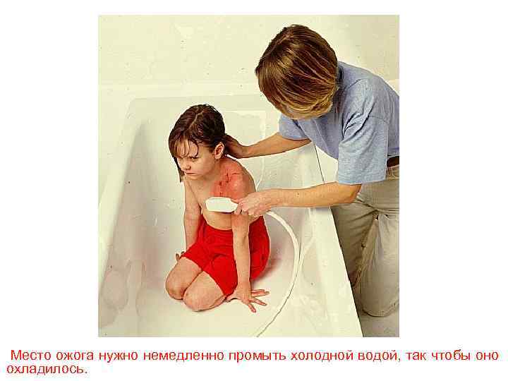 Место ожога нужно немедленно промыть холодной водой, так чтобы оно охладилось. 