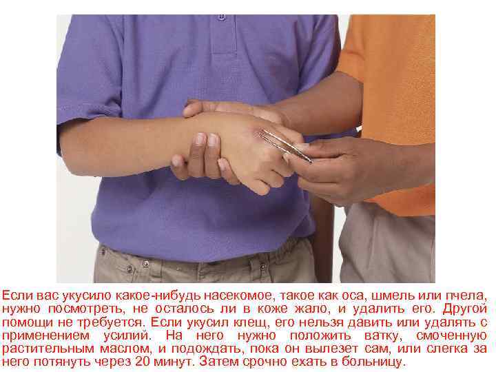Если вас укусило какое-нибудь насекомое, такое как оса, шмель или пчела, нужно посмотреть, не
