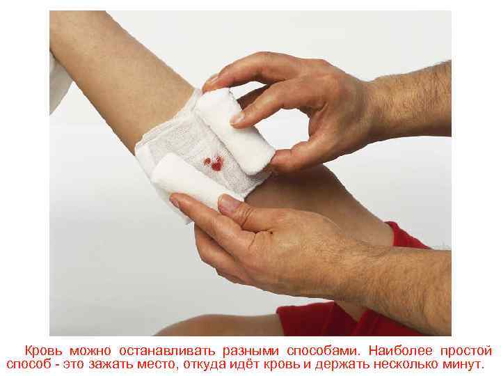 Кровь можно останавливать разными способами. Наиболее простой способ - это зажать место, откуда идёт