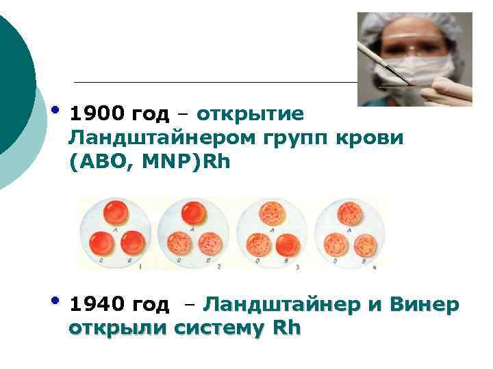  • 1900 год – открытие Ландштайнером групп крови (АВО, MNP)Rh • 1940 год