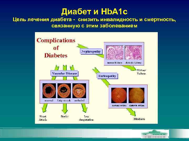 Диабет и Hb. A 1 c Цель лечения диабета - снизить инвалидность и смертность,