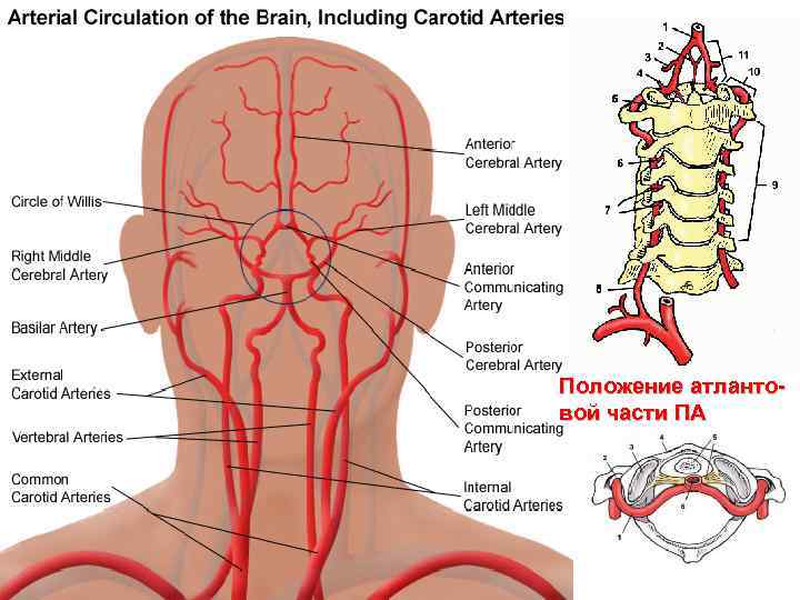 Положение атлантовой части ПА 