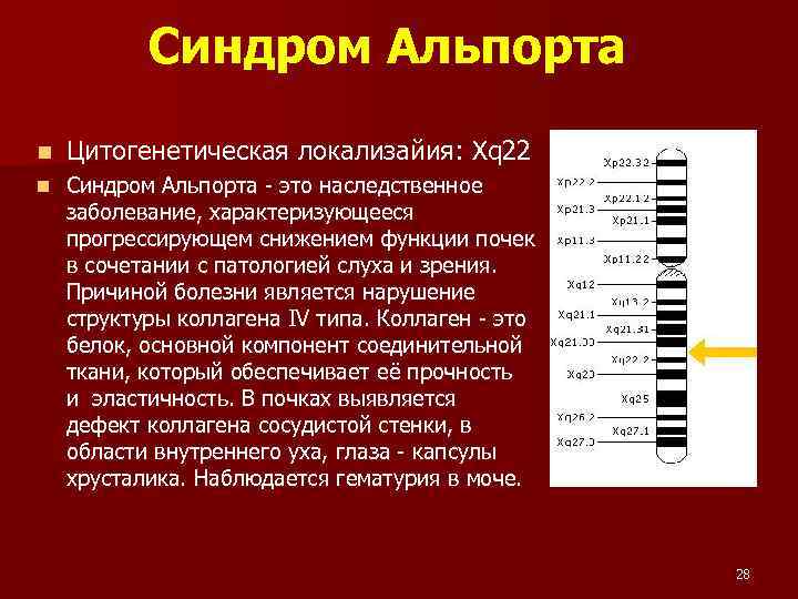 Синдром Альпорта n Цитогенетическая локализайия: Xq 22 n Синдром Альпорта - это наследственное заболевание,