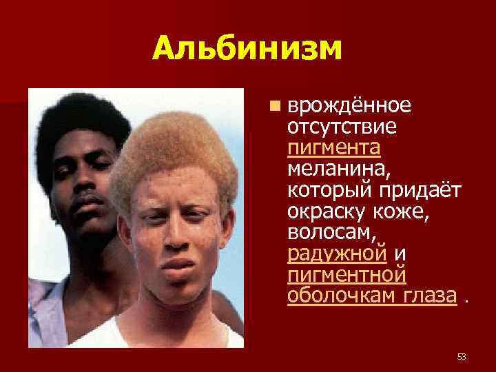 Альбинизм n врождённое отсутствие пигмента меланина, который придаёт окраску коже, волосам, радужной и пигментной