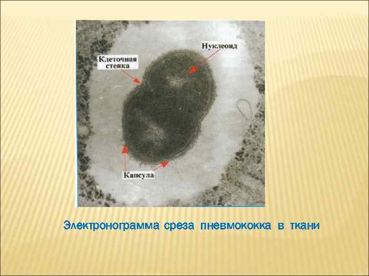 Электронограмма среза пневмококка в ткани 