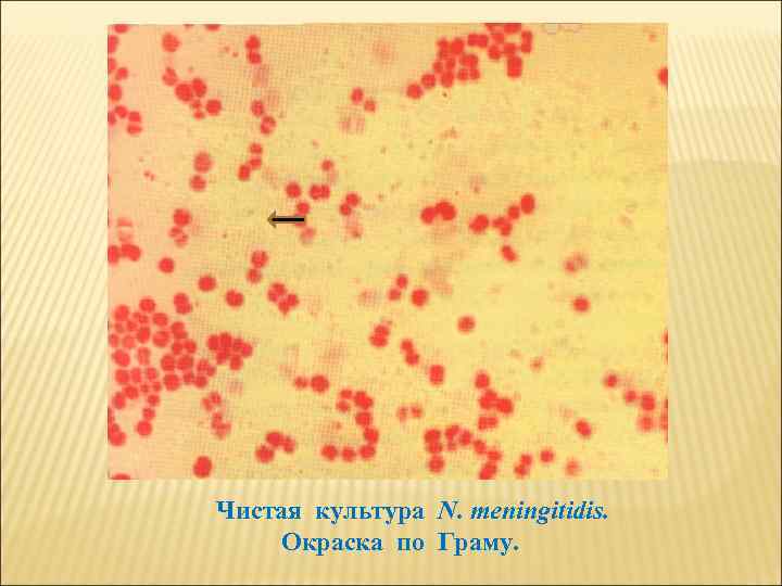 Чистая культура N. meningitidis. Окраска по Граму. 
