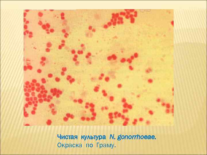 Чистая культура N. gonorrhoeae. Окраска по Граму. 