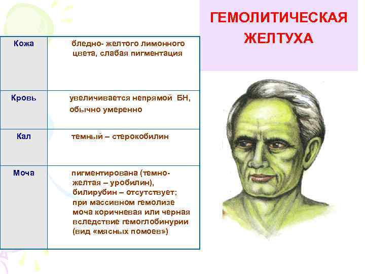 Кожа бледно- желтого лимонного цвета, слабая пигментация Кровь увеличивается непрямой БН, обычно умеренно Кал