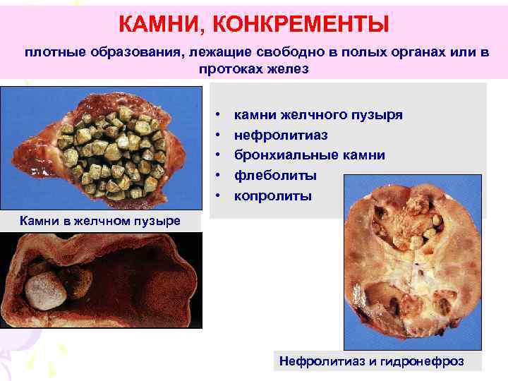 Дистрофия 3 степени фото