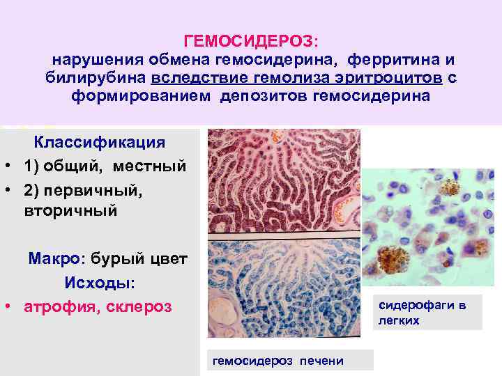 Определение степени липемии иктеричности и гемолиза образца