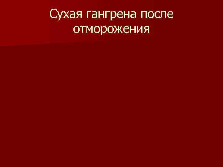 Сухая гангрена после отморожения 