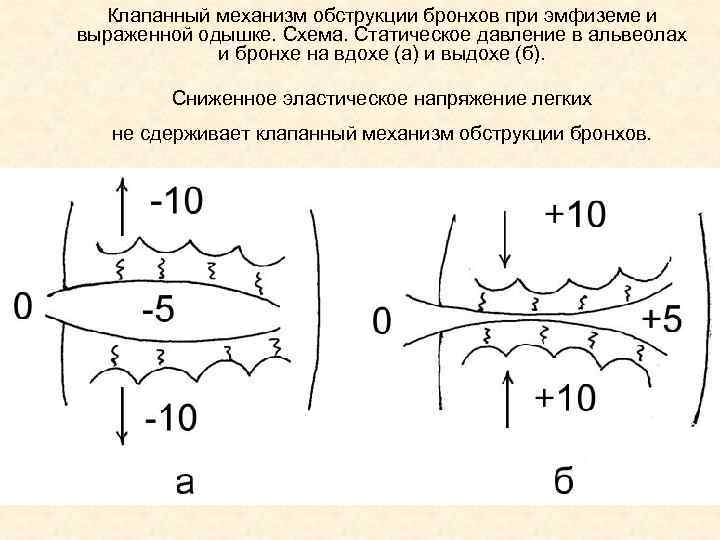 Заполните словесную схему механизма дыхания